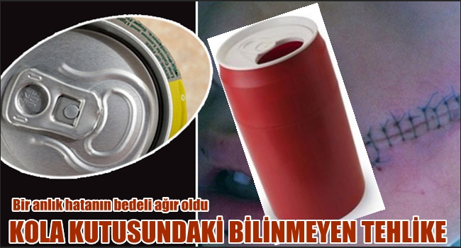 Dikkat! Cola kutusu elinizde patlayabilir